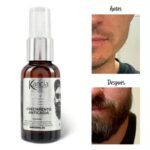 CAPIXYL HOMBRE 5% 1